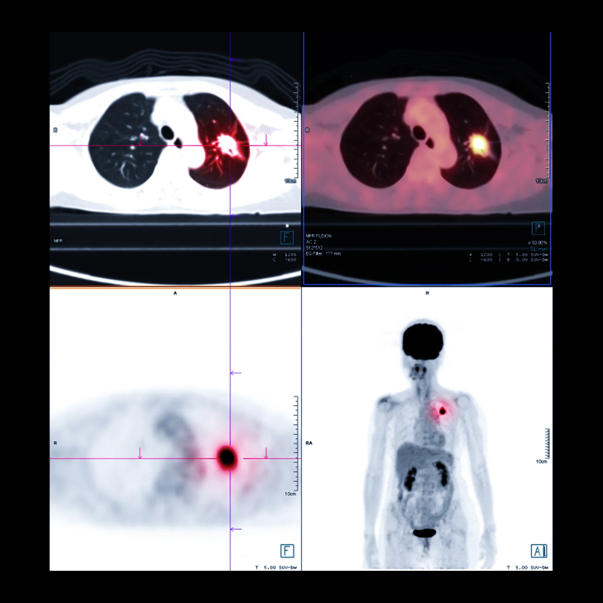 A scan of a patient